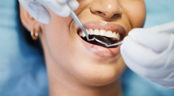 Best Walk-In Emergency Dentist in Moundsville, WV